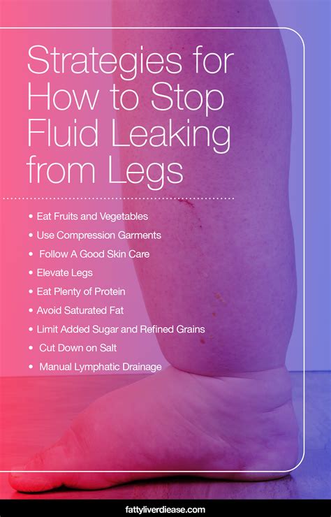 legs leaking fluid|6 tips for managing leaky legs